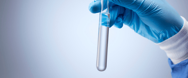 Raw Water Quality Analysis - banner